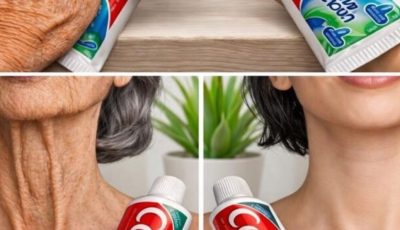 They thought I had cosmetic surgery… but it was this home remedy