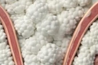 Why Peeing After Sex Could Be the Simplest Game-Changer for Your Urinary Tract Health and Peace of Mind