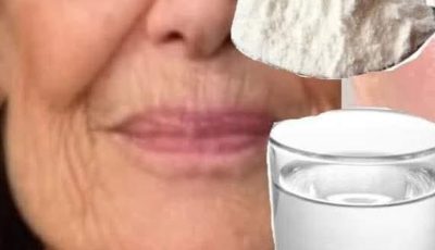 Face Lift with Natural Collagen! At 70 Years, Wrinkles Disappear in 3 Minutes! 🌟 (Baking Soda & Water Skin Care)
