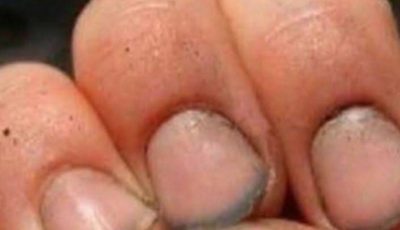 What do you call a person who has nails like that?
