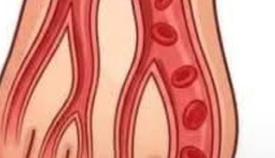 Suffering from poor circulation? Here’s how to fix it in just 20 minutes!