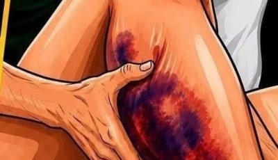 If You Get Leg Cramps at Night, You Need to Know This Immediately
